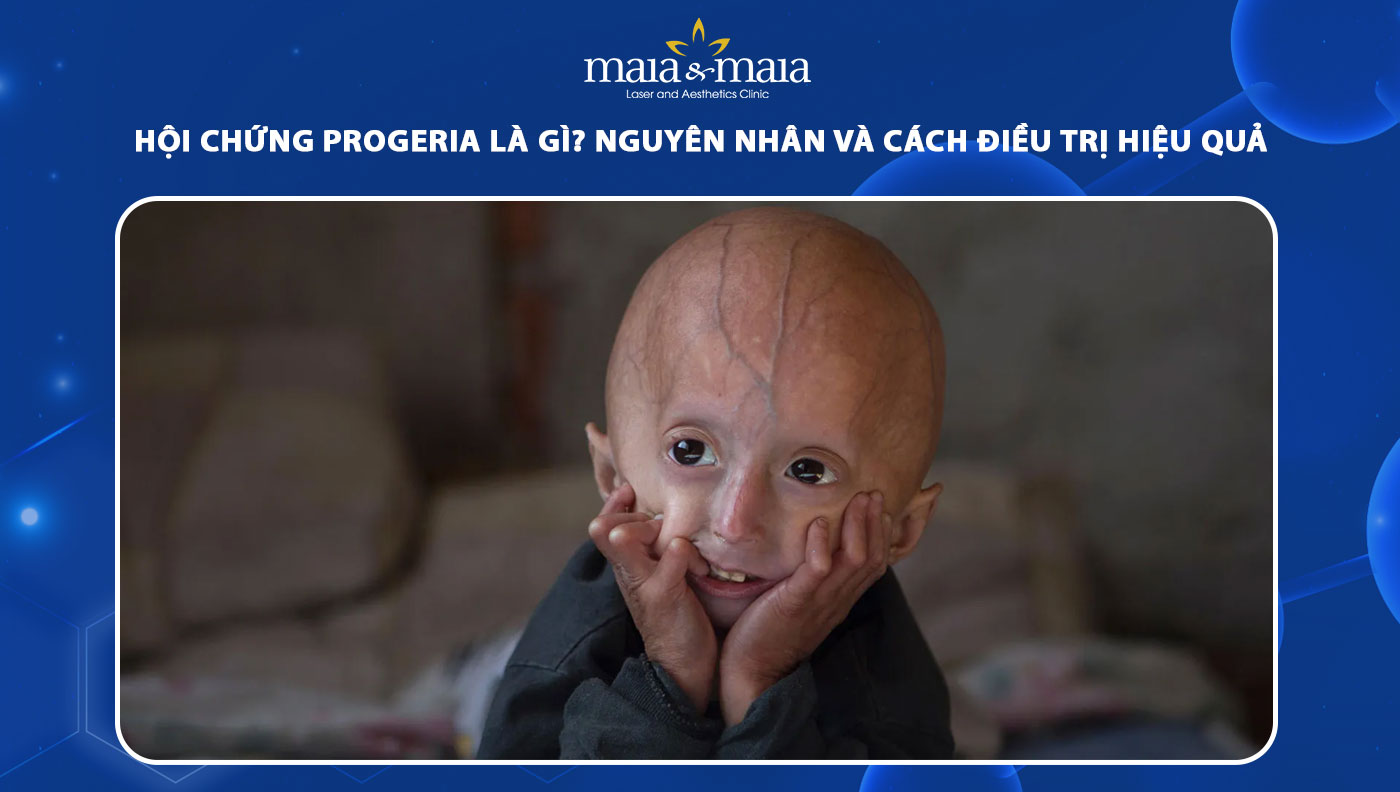 hội chứng Progeria