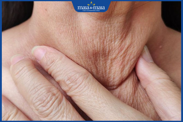 lão hóa cổ do tuổi tác