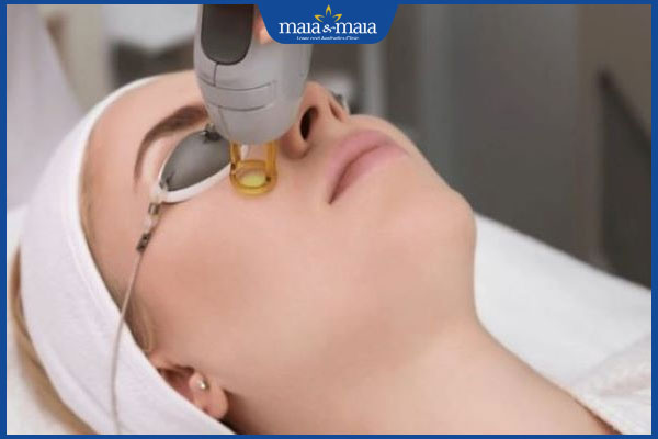 laser vi điểm