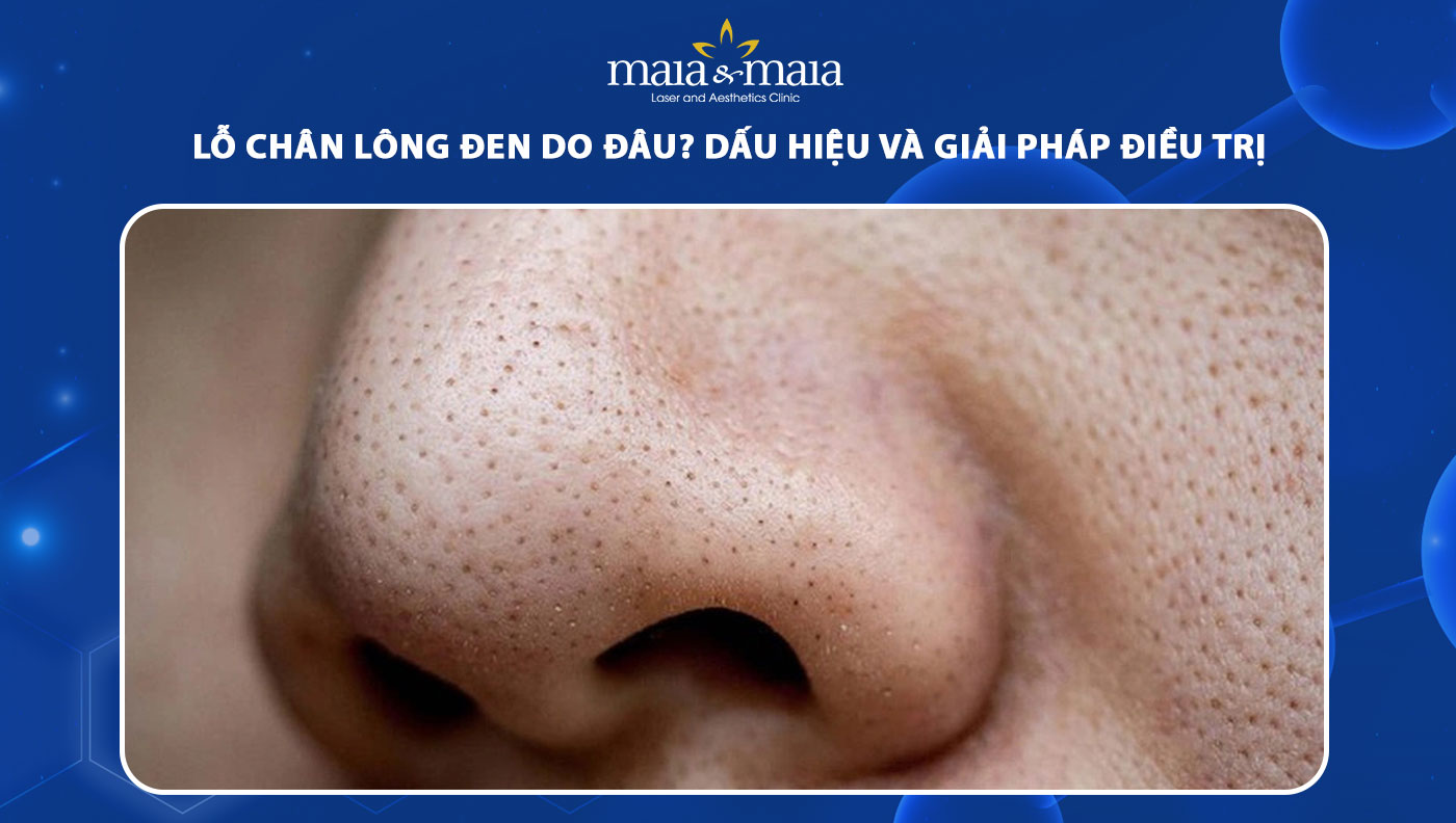 lỗ chân lông đen