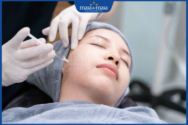 Muốn tiêm căng bóng da mặt an toàn đọc kinh nghiệm dưới đây 4 quy trình tiêm căng bóng