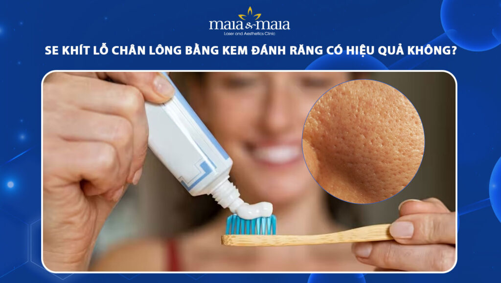 se khít lỗ chân lông bằng kem đánh răng