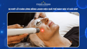 se khít lỗ chân lông bằng laser