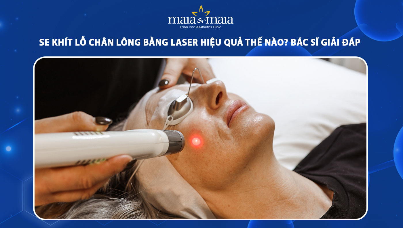 se khít lỗ chân lông bằng laser