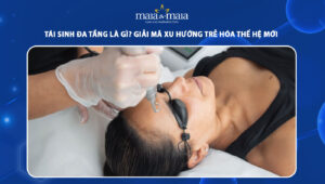 tái sinh đa tầng