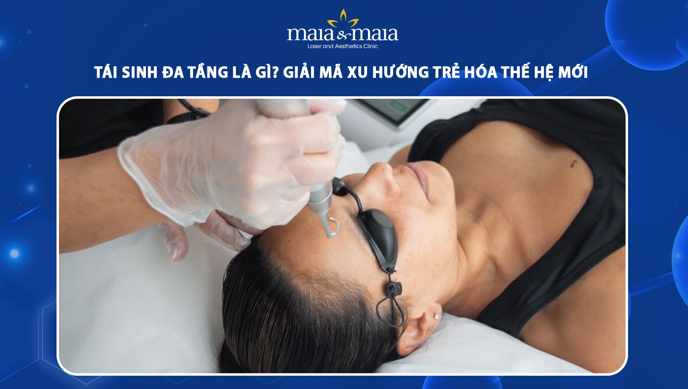 tái sinh đa tầng