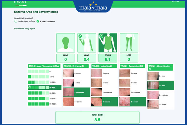 Phác đồ điều trị viêm da dị ứng theo từng mức độ bệnh 3 thang đánh giá EASI