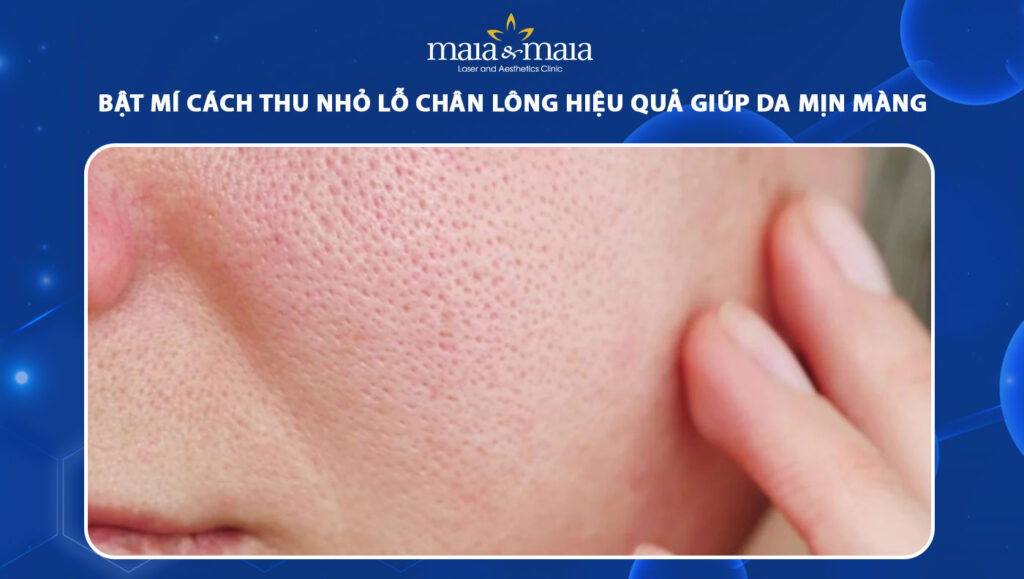 Bật mí cách thu nhỏ lỗ chân lông hiệu quả giúp da mịn màng 1 thu nhỏ lỗ chân lông