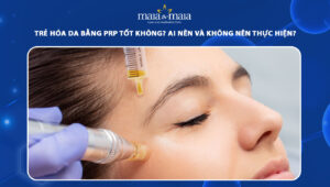 trẻ hóa da bằng prp
