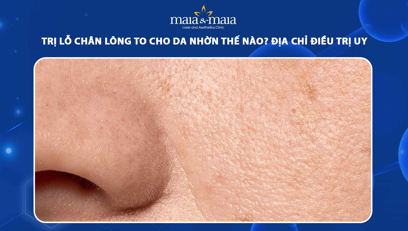 trị lỗ chân lông to cho da nhờn