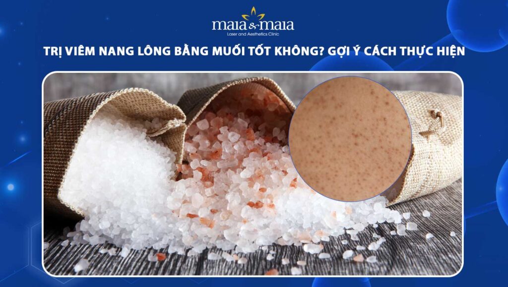 trị viêm nang lông bằng muối