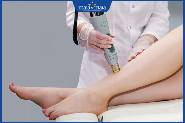 chiếu laser trị viêm nang lông