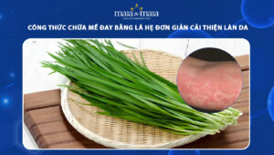 chữa mề đay bằng lá hẹ