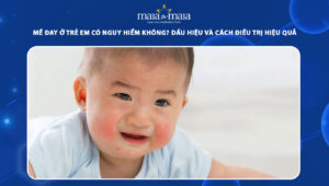 mề đay ở trẻ em