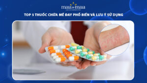 thuốc chữa mề đay