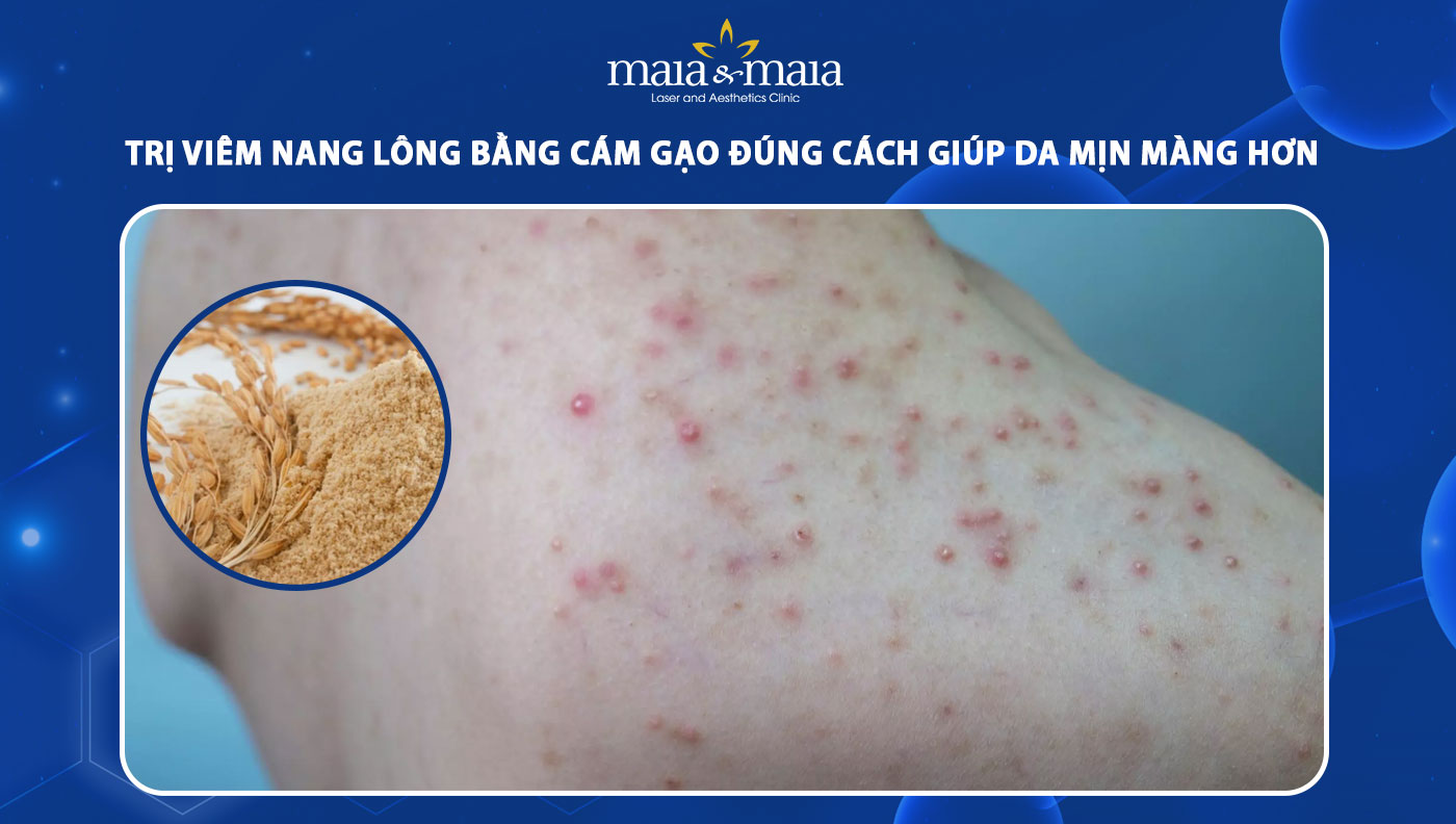 trị viêm nang lông bằng cám gạo
