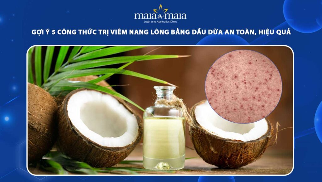trị viêm nang lông bằng dầu dừa