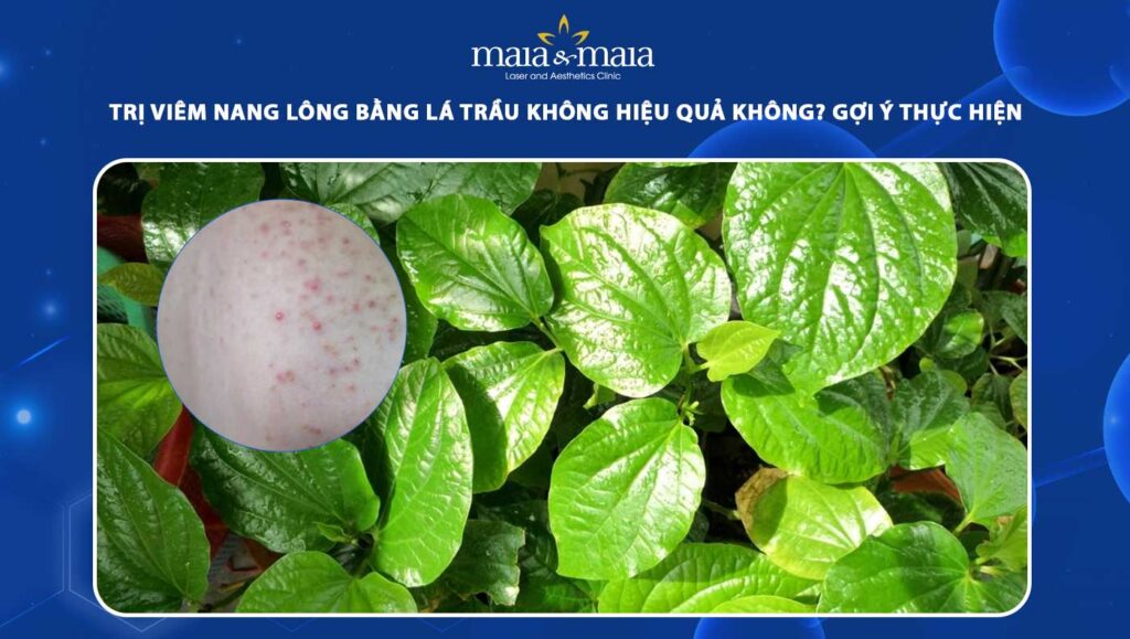 trị viêm nang lông bằng lá trầu không