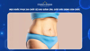 da chảy xệ sau giảm cân