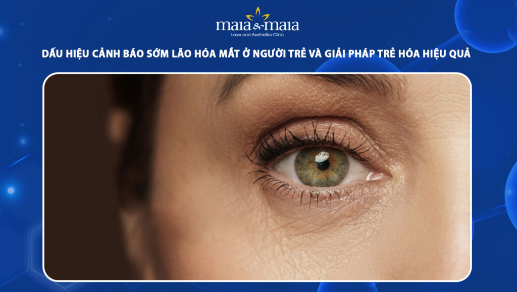 Dấu hiệu cảnh báo lão hóa mắt ở người trẻ và cách khắc phục 1 lão hóa mắt ở người trẻ