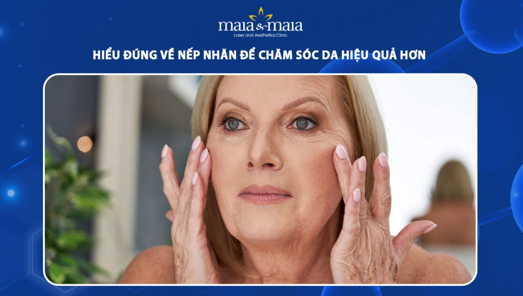nếp nhăn