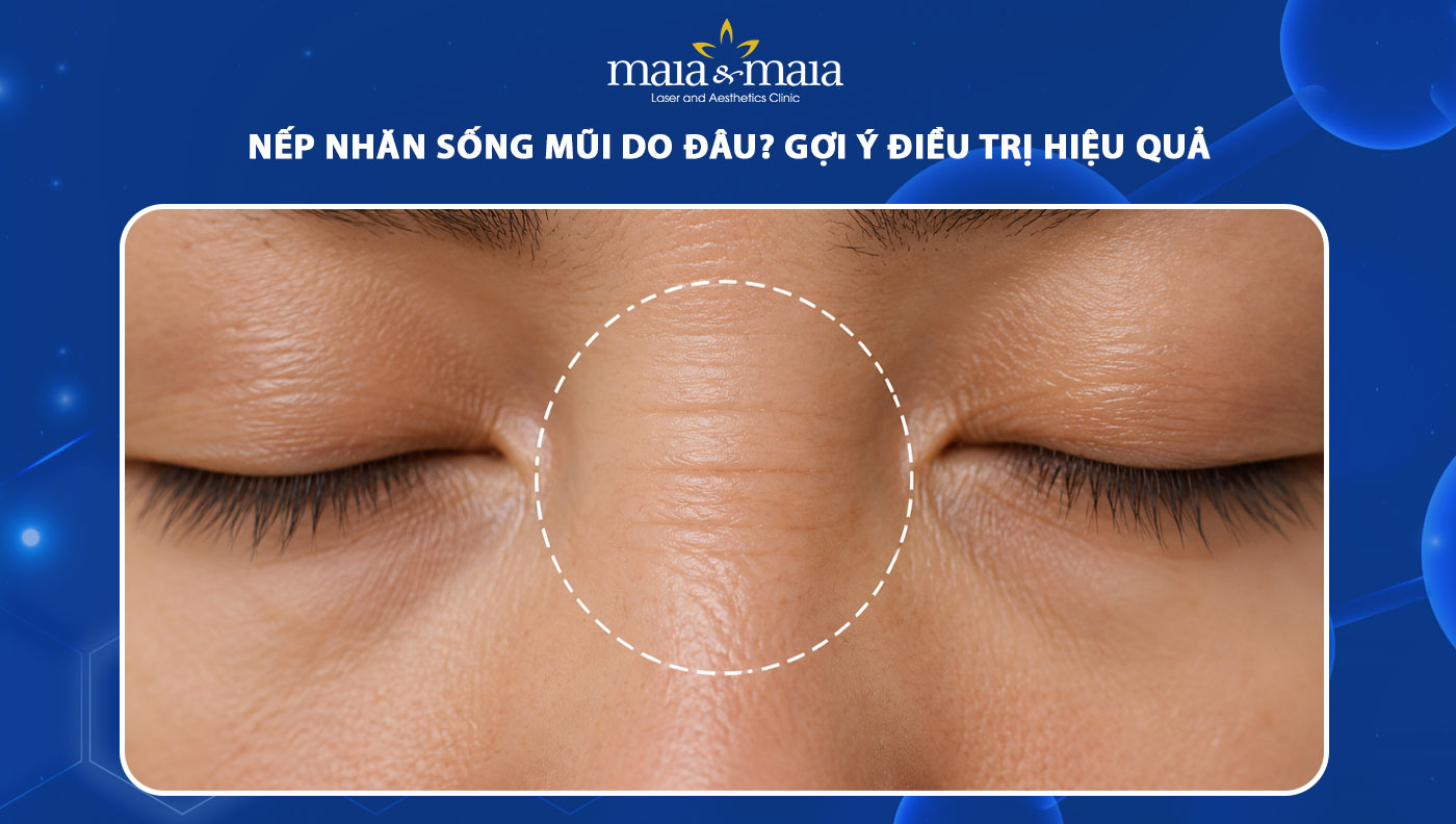 nếp nhăn sống mũi