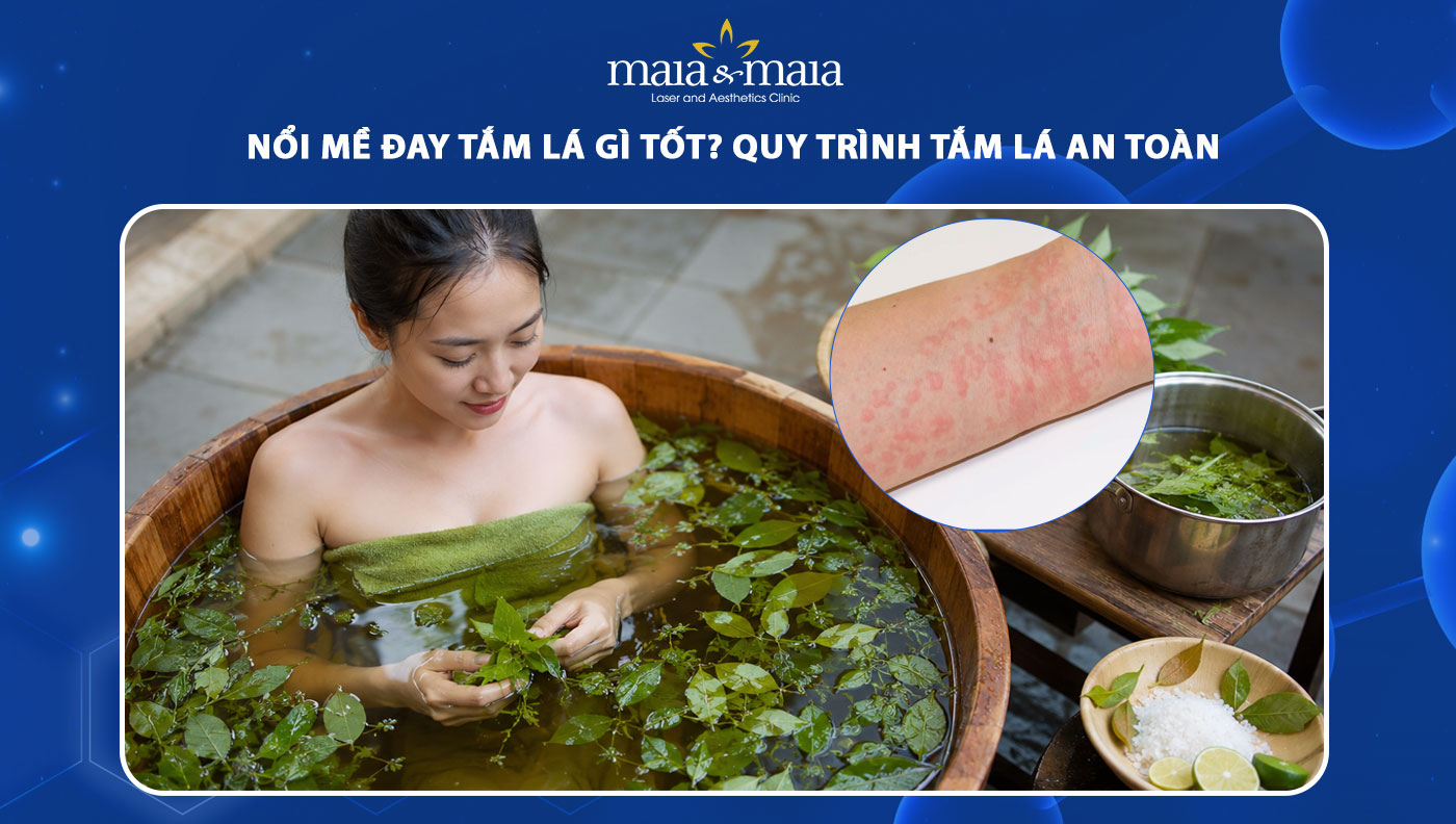 nổi mề đay tắm lá gì