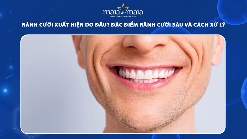 Xóa rãnh cười an toàn, hạn chế tái phát với công nghệ cao 1 rãnh cười