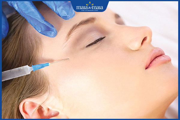 tiêm botox dưới mắt