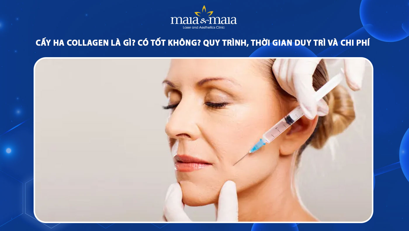 cấy HA collagen