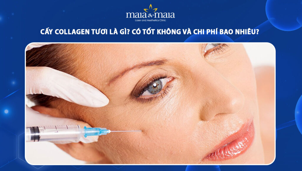 cấy collagen tươi