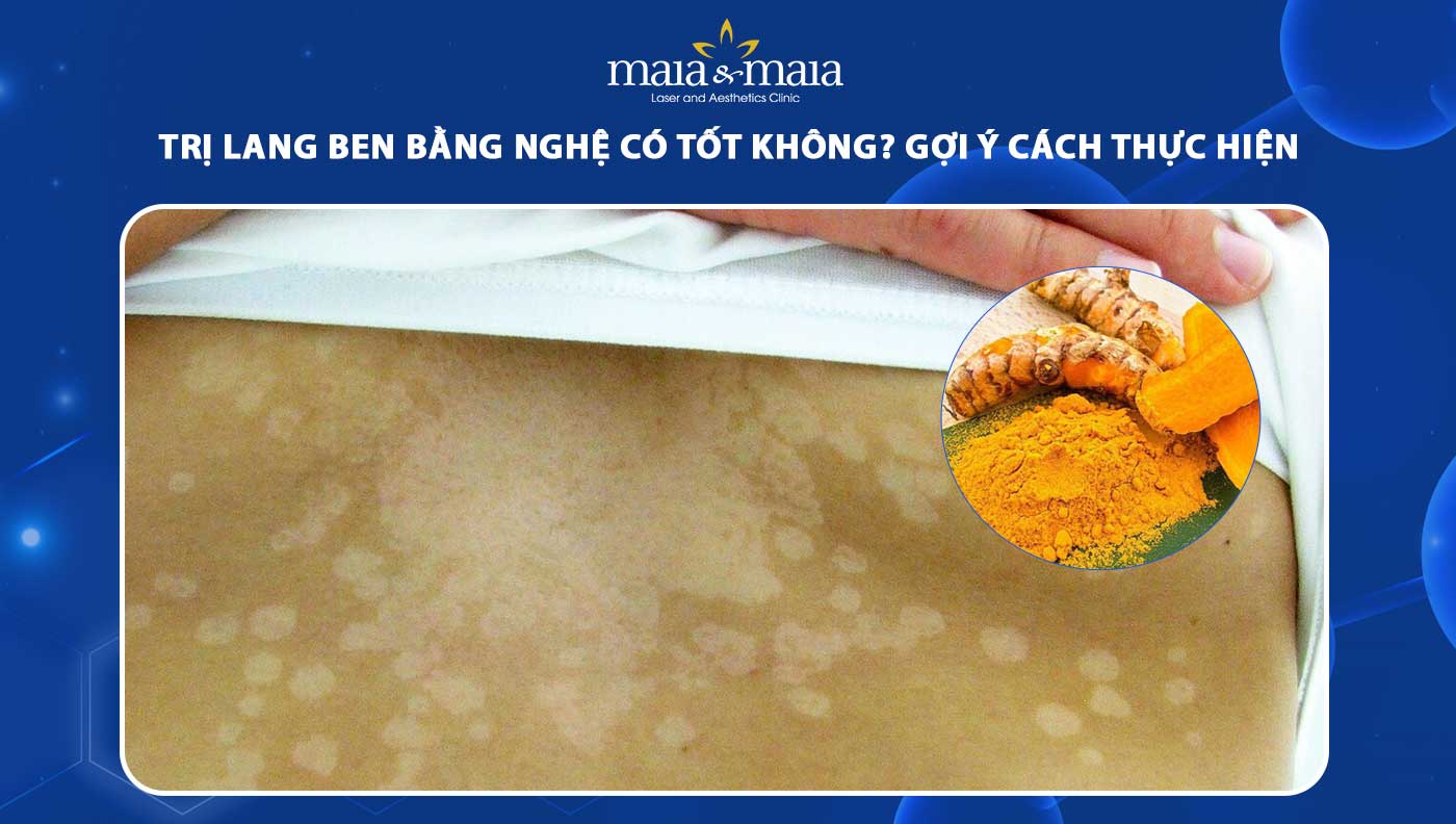 trị lang ben bằng nghệ