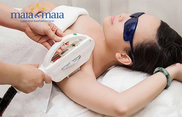 Triệt lông công nghệ Laser Diode Triệt lông công nghệ Laser Diode